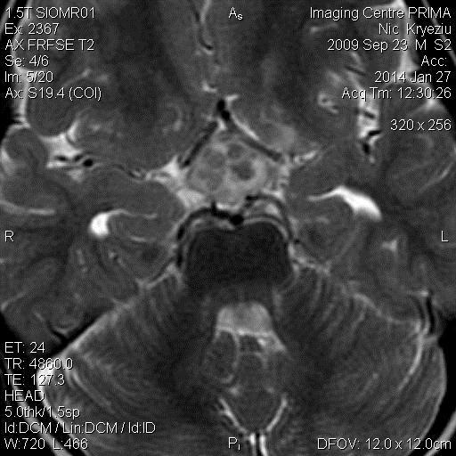 Fig.1