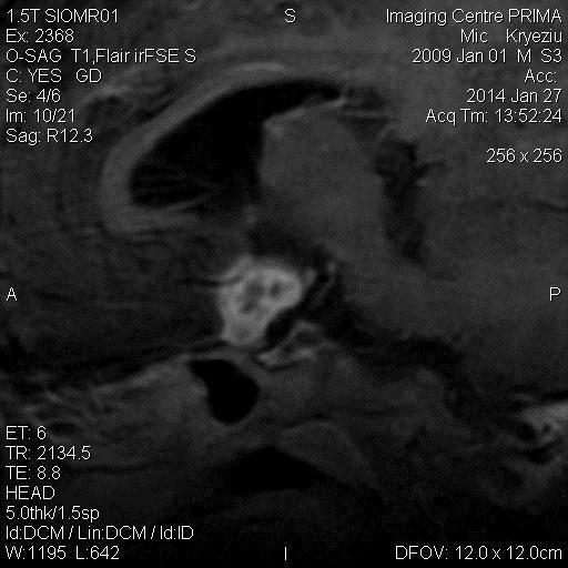 Fig.2