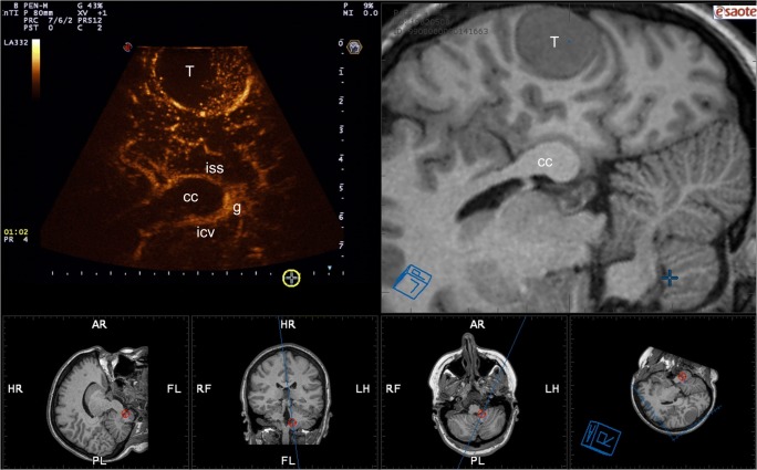 Fig. 10