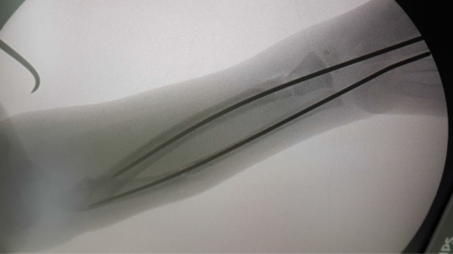 Fig. 2