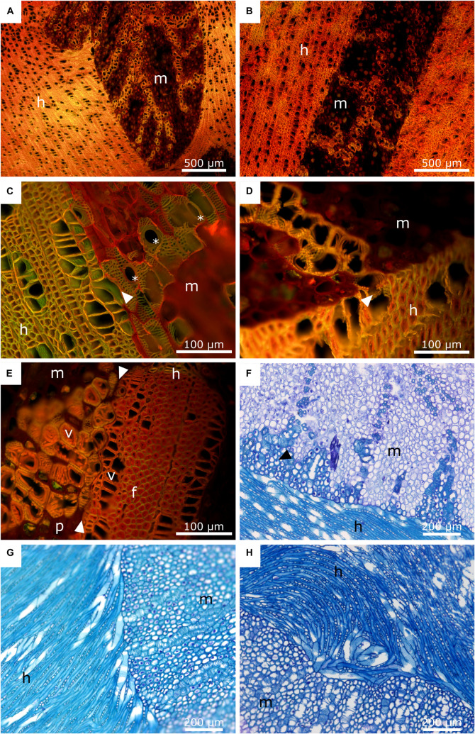 Advances On The Visualization Of The Internal Structures Of The 