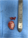Fig. 6