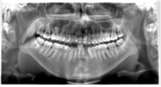 Fig. 11