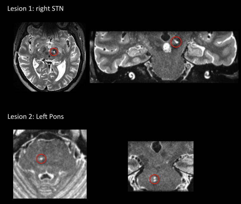 Fig. 1