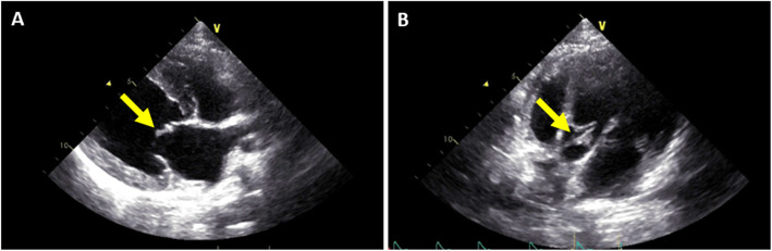 Fig. 2