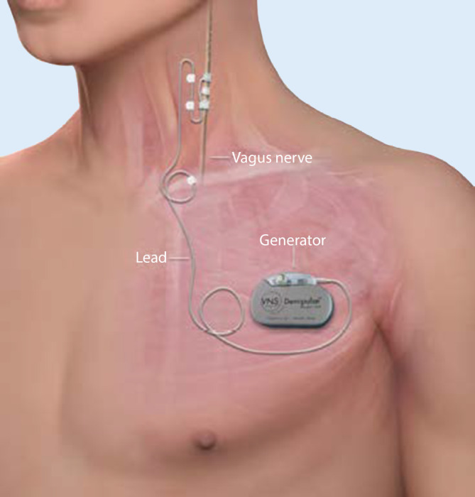 graphic file with name 115_2022_1282_Fig1_HTML.jpg