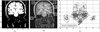 Fig. 15