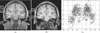 Fig. 18