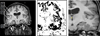 Fig. 17