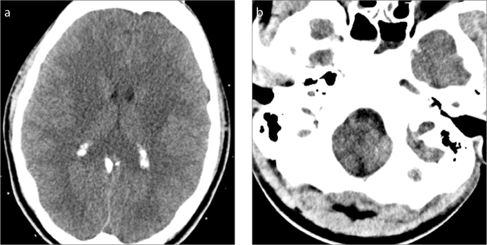 Figure 4. a, b