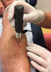 graphic file with name JBM4-7-e10799-g002.jpg