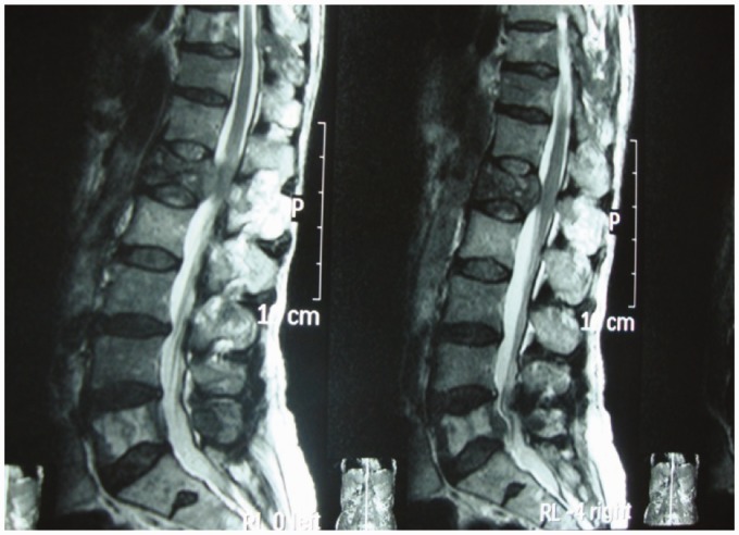 Figure 13.