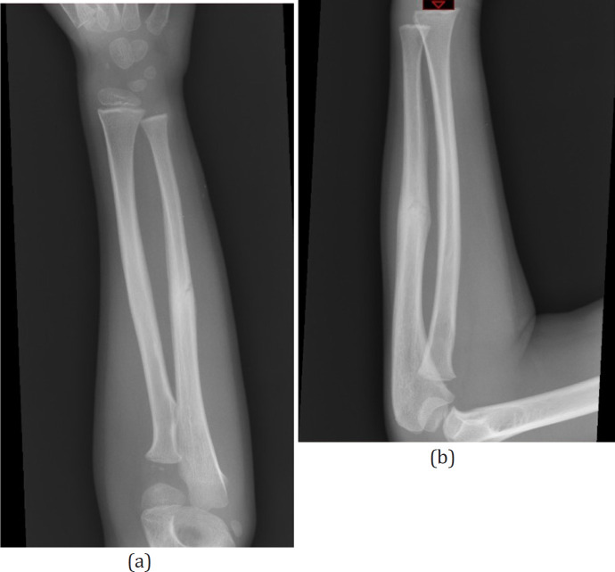 Figure 5a, b