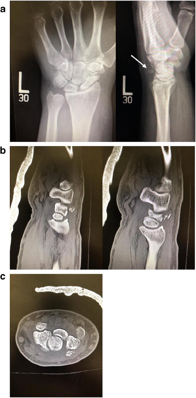 Fig. 1