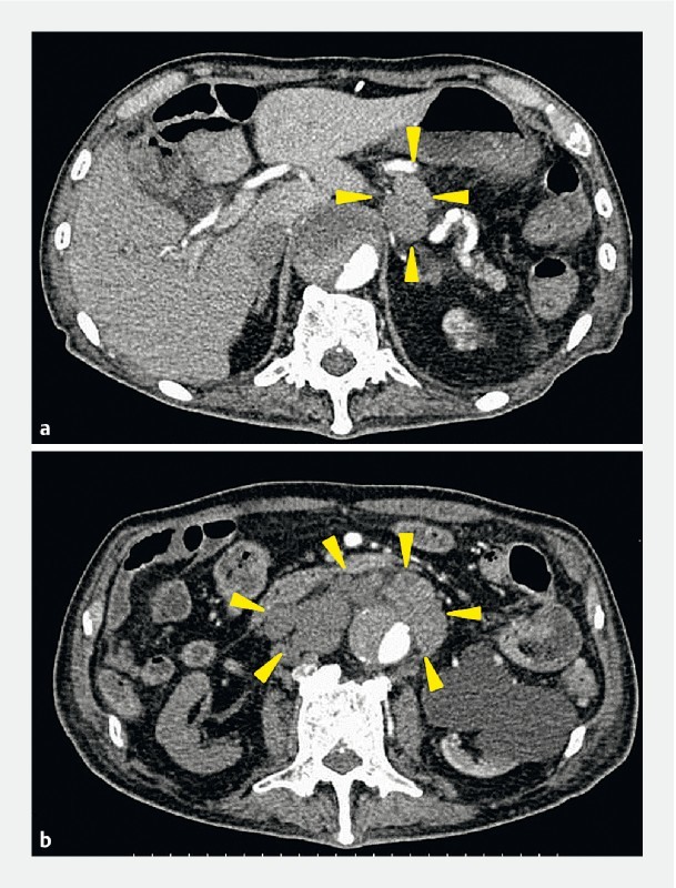 Fig. 4 