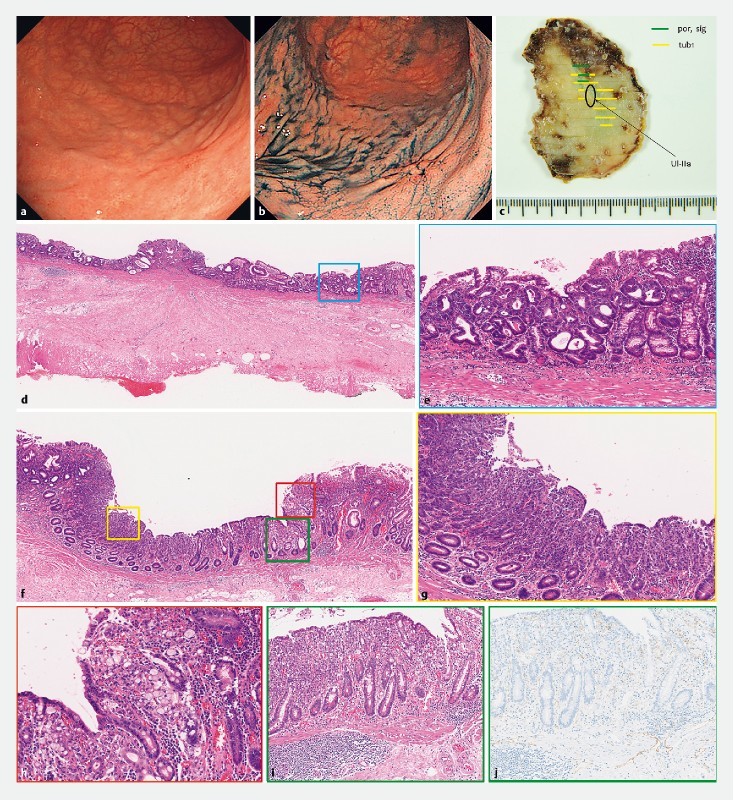 Fig. 1 a, b