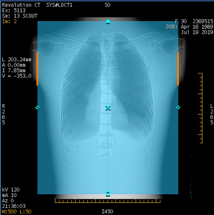 Figure 9