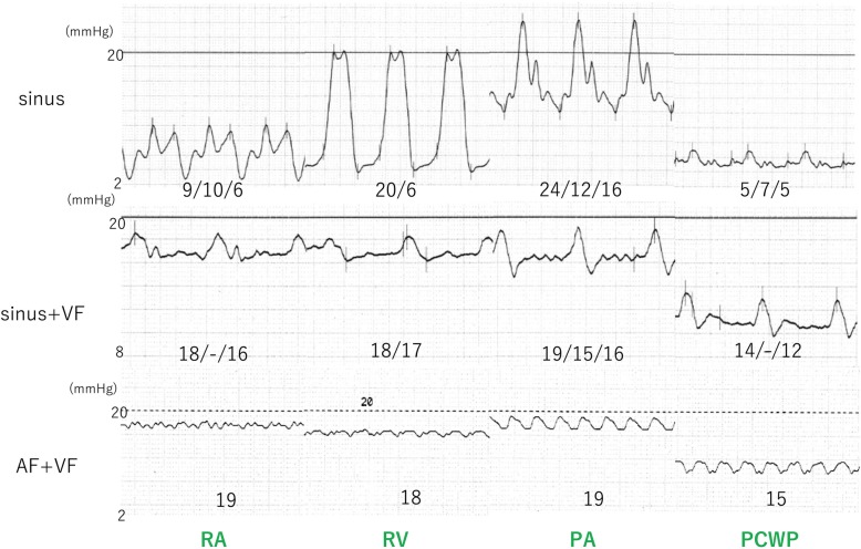 Fig. 3