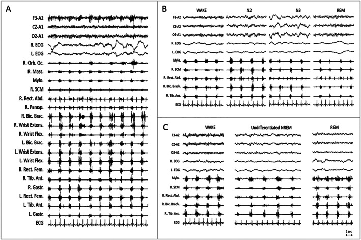 FIG. 1