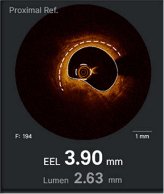 FIGURE 6