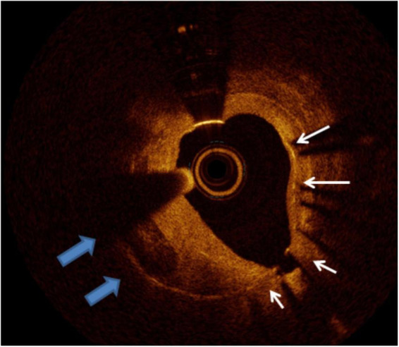 FIGURE 11