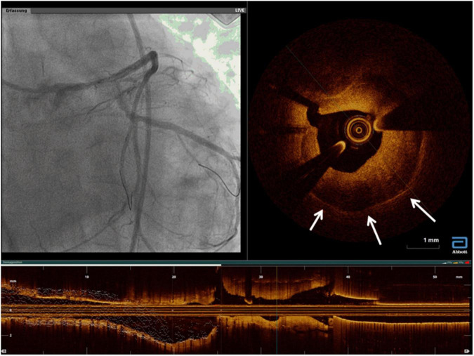 FIGURE 13