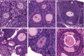 Fig. 10