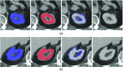 Fig. 11