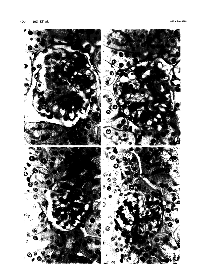400