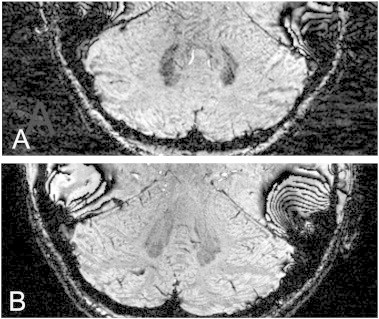 Fig. 1