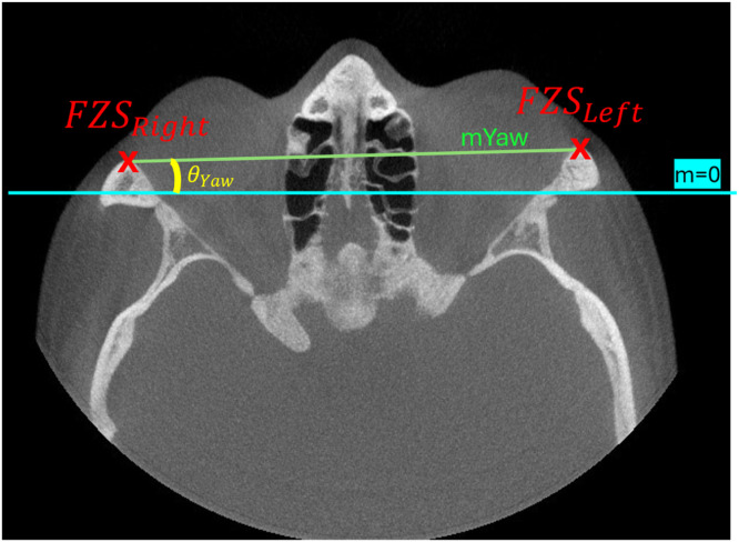 Fig 3