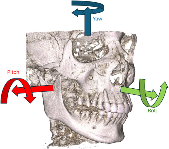 Fig 1