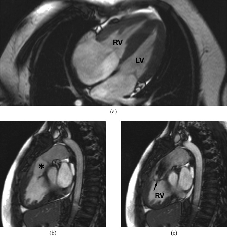 Figure 3.MRI