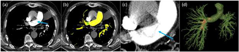 Fig. 7.