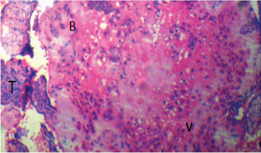 [Table/Fig-4]: