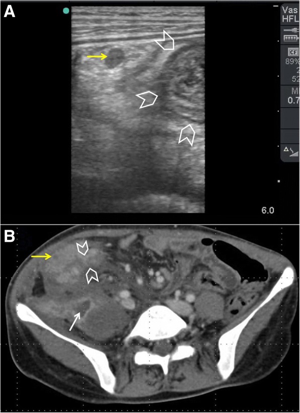 Fig. 13