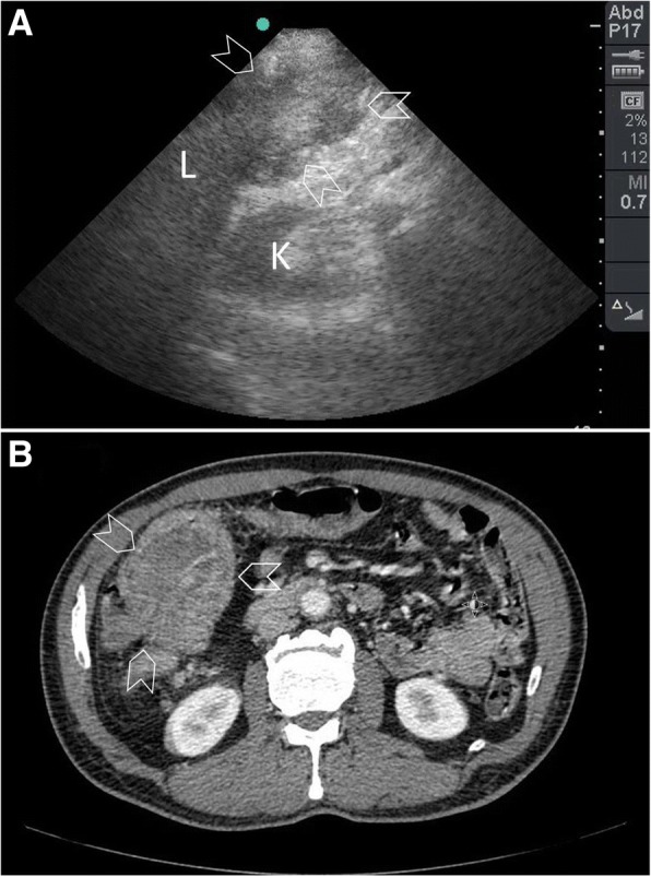 Fig. 15