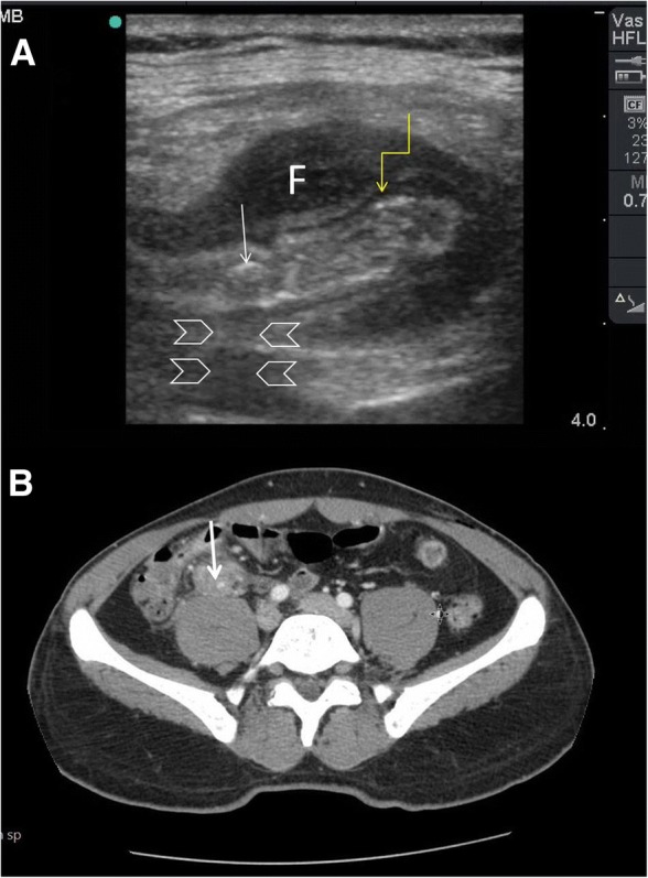 Fig. 9