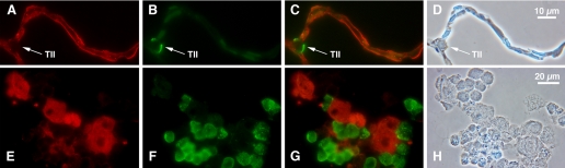 Fig. 11.