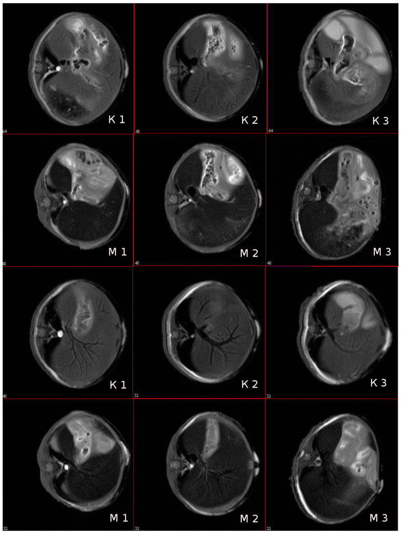 Figure 14