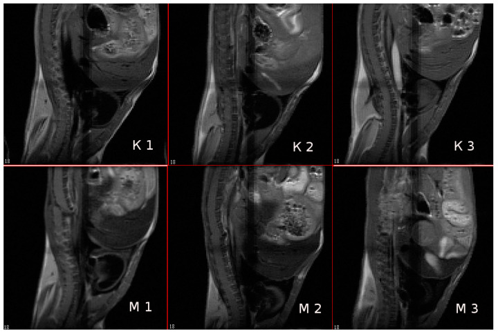 Figure 13