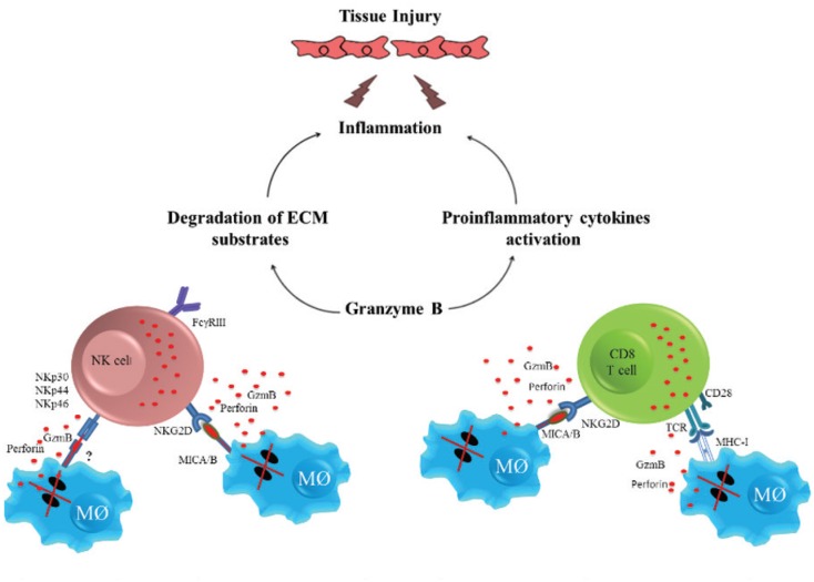 Tissue damage and inflammation mediated by cytotoxic cells in human cutaneous leishmaniasis. With degranulation of natural killer (NK) and CD8+ T cells, granzyme B (GzmB) and perforin are released and apoptosis of infected macrophages is induced. Additionally, granzyme B may indirectly induce inflammation through the activation of pro-inflammatory cytokines and degradation of extracellular matrix (ECM) substrates, contributing to tissue damage. *This image has not been previously published.