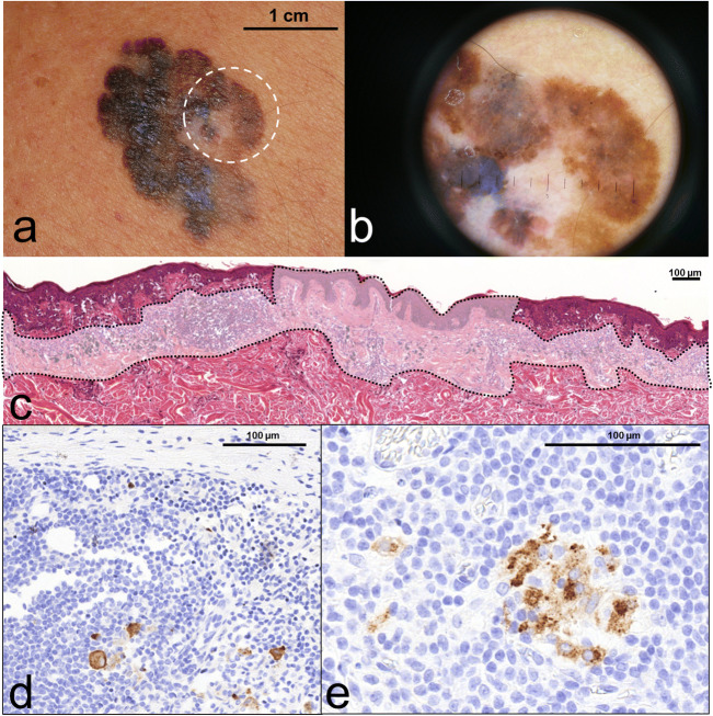 Fig. 1