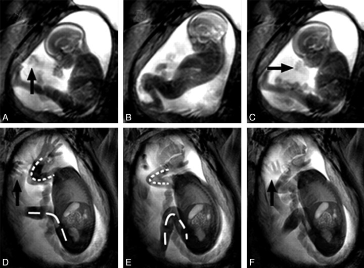 Fig 2.