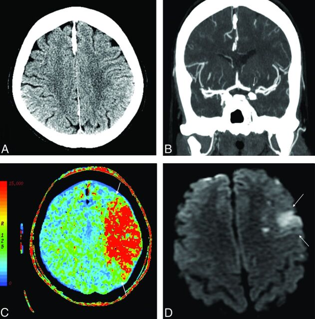 Fig 1.