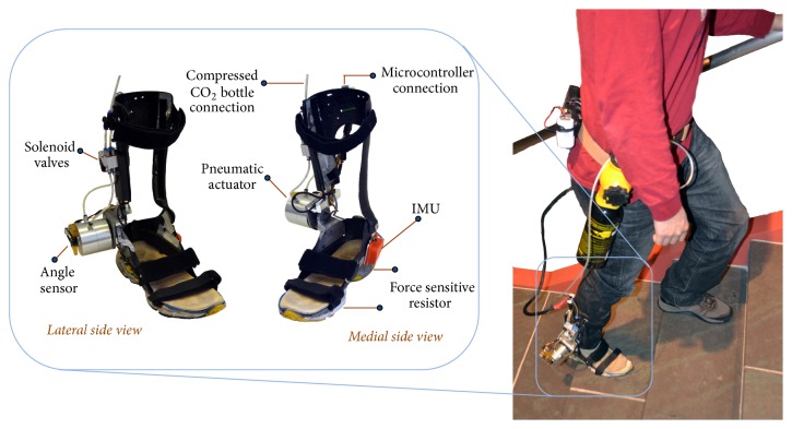 Figure 1