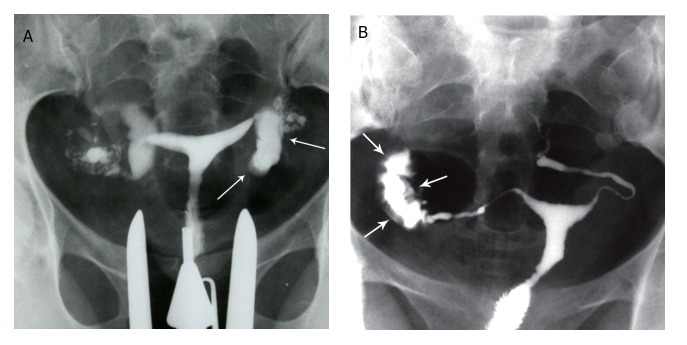 Fig 15