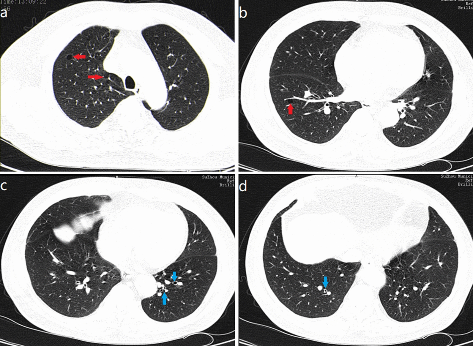 Fig. 2