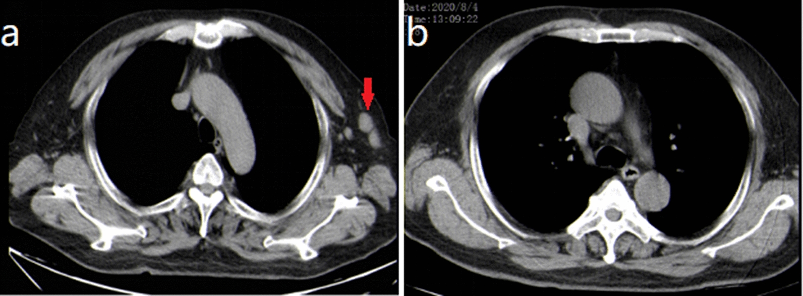 Fig. 5