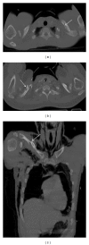 Figure 15